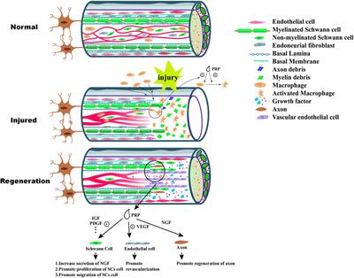 Evaluation of Platelet-Rich Plasma Therapy for Peripheral Nerve Regeneration: A Critical Review of Literature